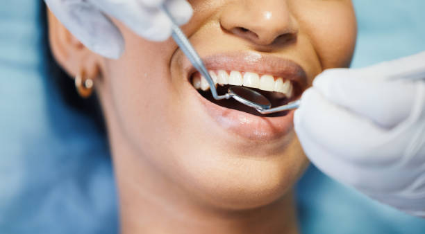 Best Broken or Cracked Tooth Emergency Dentist in San Antonio, FL