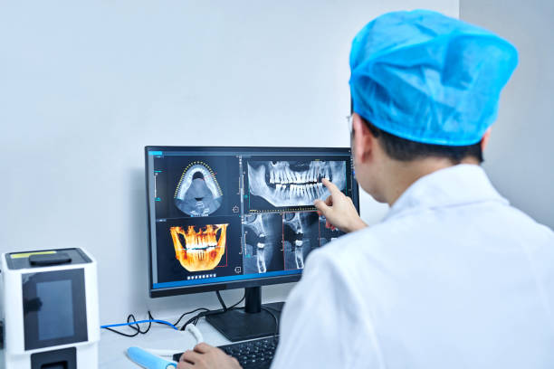 Best Emergency Root Canal Treatment in San Antonio, FL
